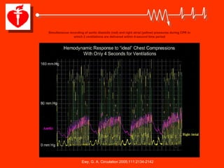 Simultaneous recording of aortic diastolic (red) and right atrial (yellow) pressures during CPR in
                which 2 ventilations are delivered within 4-second time period




                      Ewy, G. A. Circulation 2005;111:2134-2142
 