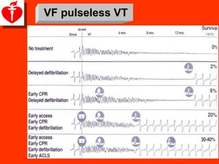 VF pulseless VT
 