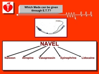 Which Meds can be given
               through E.T.T?




                     NAVEL

Naloxon   Atropine   Vasopressin     Epinephrine   Lidocaine
 