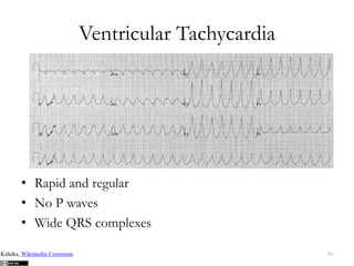 ACLS Presentation.pptx