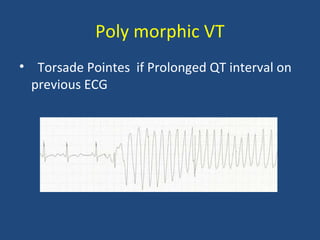 Poly morphic VT
• Torsade Pointes if Prolonged QT interval on
previous ECG
 