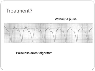 Treatment?
Without a pulse

Pulseless arrest algorithm

 