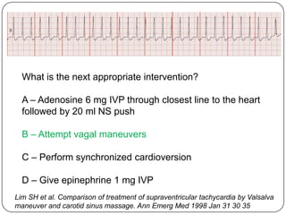 What is the next appropriate intervention?
A – Adenosine 6 mg IVP through closest line to the heart
followed by 20 ml NS push
B – Attempt vagal maneuvers
C – Perform synchronized cardioversion
D – Give epinephrine 1 mg IVP
Lim SH et al. Comparison of treatment of supraventricular tachycardia by Valsalva
maneuver and carotid sinus massage. Ann Emerg Med 1998 Jan 31 30 35

 