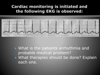  What is the patients arrhythmia and
probable medical problem?
 What therapies should be done? Explain
each one.
 