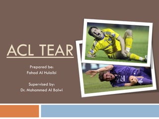 ACL TEAR
Prepared be:
Fahad Al Hulaibi
Supervised by:
Dr. Mohammed Al Balwi

 
