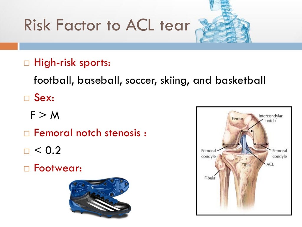 ACL tear