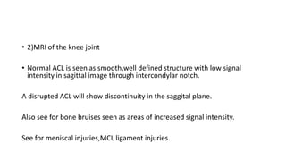 • 2)MRI of the knee joint
• Normal ACL is seen as smooth,well defined structure with low signal
intensity in sagittal image through intercondylar notch.
A disrupted ACL will show discontinuity in the saggital plane.
Also see for bone bruises seen as areas of increased signal intensity.
See for meniscal injuries,MCL ligament injuries.
 