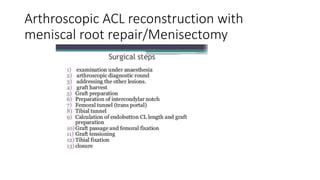 Arthroscopic ACL reconstruction with
meniscal root repair/Menisectomy
 