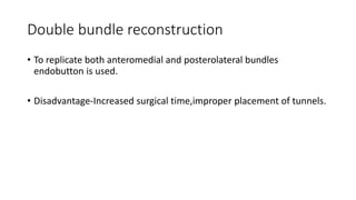 Double bundle reconstruction
• To replicate both anteromedial and posterolateral bundles
endobutton is used.
• Disadvantage-Increased surgical time,improper placement of tunnels.
 