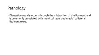 Pathology
• Disruption usually occurs through the midportion of the ligament and
is commonly associated with meniscal tears and medial collateral
ligament tears.
 