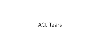 ACL Tears
 