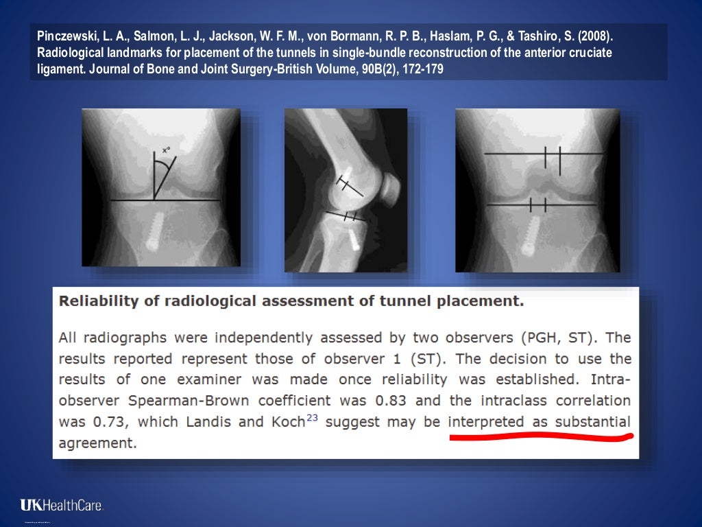 Assessment of Femoral Tunnel Placement in ACL Reconstruction