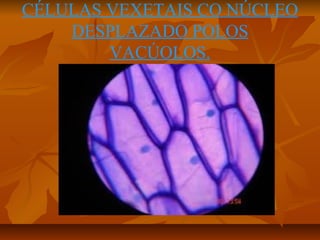 CÉLULAS VEXETAIS CO NÚCLEO
DESPLAZADO POLOS
VACÚOLOS.

 