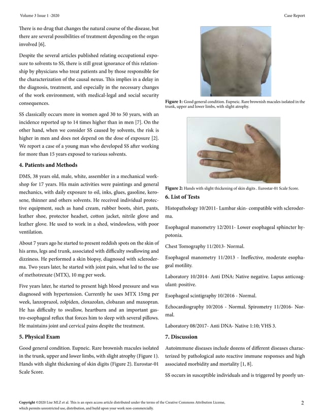 Systemic Sclerosis Associated with Occupational Exposure to Solvents | PDF