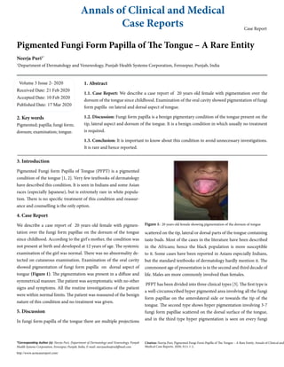 Annals of Clinical and Medical
Case Reports Case Report
Pigmented Fungi Form Papilla of The Tongue – A Rare Entity
Neerja Puri1*
1
Department of Dermatology and Venereology, Punjab Health Systems Corporation, Ferozepur, Punjab, India
Volume 3 Issue 2- 2020
Received Date: 21 Feb 2020
Accepted Date: 10 Feb 2020
Published Date: 17 Mar 2020
2. Key words
Pigmented; papilla; fungi form;
dorsum; examination; tongue.
1. Abstract
1.1. Case Report: We describe a case report of 20 years old female with pigmentation over the
dorsum of the tongue since childhood. Examination of the oral cavity showed pigmentation of fungi
form papilla on lateral and dorsal aspect of tongue.
1.2. Discussion: Fungi form papilla is a benign pigmentary condition of the tongue present on the
tip, lateral aspect and dorsum of the tongue. It is a benign condition in which usually no treatment
is required.
1.3. Conclusion: It is important to know about this condition to avoid unnecessary investigations.
It is rare and hence reported.
3. Introduction
Pigmented Fungi form Papilla of Tongue (PFPT) is a pigmented
condition of the tongue [1, 2]. Very few textbooks of dermatology
have described this condition. It is seen in Indians and some Asian
races (especially Japanese), but is extremely rare in white popula-
tion. There is no specific treatment of this condition and reassur-
ance and counselling is the only option.
4. Case Report
We describe a case report of 20 years old female with pigmen-
tation over the fungi form papillae on the dorsum of the tongue
since childhood. According to the girl's mother, the condition was
not present at birth and developed at 12 years of age. The systemic
examination of the girl was normal. There was no abnormality de-
tected on cutaneous examination. Examination of the oral cavity
showed pigmentation of fungi form papilla on dorsal aspect of
tongue (Figure 1). The pigmentation was present in a diffuse and
symmetrical manner. The patient was asymptomatic with no other
signs and symptoms. All the routine investigations of the patient
were within normal limits. The patient was reassured of the benign
nature of this condition and no treatment was given.
5. Discussion
In fungi form papilla of the tongue there are multiple projections
scattered on the tip, lateral or dorsal parts of the tongue containing
taste buds. Most of the cases in the literature have been described
in the Africans; hence the black population is more susceptible
to it. Some cases have been reported in Asians especially Indians,
but the standard textbooks of dermatology hardly mention it. The
commonest age of presentation is in the second and third decade of
life. Males are more commonly involved than females.
PFPT has been divided into three clinical types [3]. The first type is
a well-circumscribed hyper pigmented area involving all the fungi
form papillae on the anterolateral side or towards the tip of the
tongue. The second type shows hyper pigmentation involving 3-7
fungi form papillae scattered on the dorsal surface of the tongue,
and in the third type hyper pigmentation is seen on every fungi
*Corresponding Author (s): Neerja Puri, Department of Dermatology and Venereology, Punjab
Health Systems Corporation, Ferozepur, Punjab, India, E-mail: neerjaashu@rediffmail.com
Citation: Neerja Puri, Pigmented Fungi Form Papilla of The Tongue – A Rare Entity. Annals of Clinical and
Medical Case Reports. 2020; 3(1): 1-2.
http://www.acmcasereport.com/
Figure 1: 20 years old female showing pigmentation of the dorsum of tongue
 