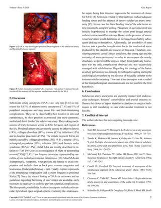Volume 4 Issue 5-2020 Case Report
Figure 2: SAA in situ, showing the proximal linear segment of the subclavian artery
and the distal tortuous segment
Figure 3: Artery reconstruction after SAA resection. This picture evidences the sub-
version of the anatomy of the superior mediastinum made by the SAA
5. Discussion
Subclavian artery aneurysms (SAAs) are very rare [1-6] as rep-
resent the 0,13% of atherosclerotic aneurysms [7, 8] and 1% of
peripheral aneurysms and may cause life- and limb-threatening
complications. They can be classified by their location in intra and
extrathoracic, by their position in proximal (the most common),
medial and distal third of the subclavian artery. The evoking mech-
anisms of SAA formation seems to differ between each region of
the SA. Proximal aneurysms are mostly caused by atherosclerosis
(19%), collagen disorders (18%), trauma (15%), infection (13%)
and in-hospital procedures (12%). The middle segment SAAs are
mainly caused by collagen disorders (23%) [9-11], trauma (15%),
in-hospital procedures (10%), infection (10%) and thoracic outlet
syndrome (TOS) (15%). Distal SAA are mostly described in re-
lation to TOS (46%) or as a consequence of blunt or penetrating
trauma (23%) [12, 13]. Less frequent causes are represented by vas-
culitis, cystic medial necrosis and tuberculosis [13]. Most SAAs are
asymptomatic, symptoms, when present, are related to local com-
pression and include chest or back pain, venous congestion and
hoarseness. Distal embolization is rare. Finally, rupture represents
a life threatening complication and is more frequent in proximal
SAAs [7]. Since the natural history of SAAs is unknown and no
guidelines regarding the timing of intervention are available, early
treatment is necessary in order to prevent potential complications.
The therapeutic possibilities for these aneurysms include endovas-
cular, hybrid and open surgical options. Currently the endovascu-
lar repair, being less invasive, represents the treatment of choice
for SAA [14]. Selection criteria for this treatment include adequate
landing zones and the absence of severe subclavian artery tortu-
osity [15]. In our case the distal landing zone of the subclavian ar-
tery presented a complete coiling. Placement of a covered stent was
initially hypothesized to manage the lesion even though arterial
catheterization would be not easy. However the presence of severe
vessel curvature would determine an increased risk of artery subse-
quent kinking or thrombosis. Additionally, the possibility of stent
fracture was a possible complication due to the mechanical stress
produced by the clavicle and muscles of this area. Therefore, con-
sidering patients’ good clinical condition, the young age and the
necessity of aneurysmectomy in order to decompress the nearby
structures, we preferred the surgical repair. Postoperatively hoarse-
ness was the only complication observed and was successfully
managed with rehabilitation. Regarding the etiology of the lesion
an artery perforation was initially hypothized occurring during the
cardiological procedure by the advance of the guide catheter in the
tortuous subclavian artery. However a true aneurysm was revealed
at the histopathological examination and did not confirm the first
hypothesis.
6. Conclusions
Subclavian artery aneurysms are currently treated with endovas-
cular techniques. Patients’ comorbidities and arterial anatomy in-
fluence the choice of repair therefore experience in surgical tech-
niques is still mandatory in case endovascular treatment is not
feasible.
7. Conflict of Interest
The authors declare that no competing interests exist.
References
1. Stahl RD,Lawrence PF,BhirangiK. Leftsubclavian artery aneurysm:
two casesof rarecongenital etiology. J VascSurg. 1999; 29: 715-718.
2. Tanaka K, Makuuchi H, Naruse Y, Kobayashi T, Goto M, Arimura
Y, et al. Multiple atherosclerotic aneurysms of the bilateral subclavi-
an artery, aortic arch and abdominal aorta. Ann Thorac Cardiovasc
Surg. 2004; 10: 126-129.
3. McCready RA, Pairolero PC, Hollier LH, Brown OW, Lie JT. Fibro-
muscular dysplasia of the right subclavian artery. Arch Surg. 1982;
117: 1243-1245.
4. Coselli JS, Crawford ES. Surgical treatment of aneurysms of the
intrathoracic segment of the subclavian artery. Chest. 1987; 91(5):
704-708.
5. Clemente C, Vidal MT, Tornos MP, Soler-Soler J. Right subclavian
artery aneurysm and coarctation of the aorta. Int J Cardiol. 1993;
43: 199-201.
6. Schindler N, Calligaro KD, Dougherty MJ, Diehl J, Modi KH, Braff-
Copyright ©2020 Tsolaki E et al. This is an open access article distributed under the terms of the Creative Commons Attribution 2
License, which permits unrestricted use, distribution, and build upon your work non-commercially.
 