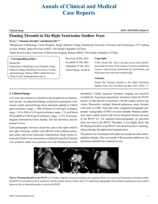 Annals of Clinical and Medical
Case Reports
Clinical Image ISSN: 2639-8109 Volume 8
Floating Thrombi in The Right Ventricular Outflow Tract
Na Li 1,2
, Osamah Alwalid1,2
and Heshui Shi1,2
*
1
Department of Radiology, Union Hospital, Tongji Medical College, Huazhong University of Science and Technology, 1277 Jiefang
Avenue, Wuhan, Hubei Province 430022, The People’s Republic of China.
2
Hubei Province Key Laboratory of Molecular Imaging, Wuhan 430022, The People’s Republic of China
*
Corresponding author:
Heshui Shi,
Department of Radiology,Union Hospital, Tongji
Medical College, Huazhong University of Science
and Technology, Wuhan 430022, Hubei Province,
China, E-mail: heshuishi@hust.edu.cn
Received: 10 Dec 2021
Accepted: 21 Dec 2021
Published: 27 Dec 2021
J Short Name: ACMCR
Copyright:
©2021 Heshui Shi. This is an open access article distrib-
uted under the terms of the Creative Commons Attribution
License, which permits unrestricted use, distribution, and
build upon your work non-commercially.
Citation:
Heshui Shi, Floating Thrombi in The Right Ventricular
Outflow Tract. Ann Clin Med Case Rep. 2021; V8(4): 1-1
1. Clinical Image
A 51-year-old woman was admitted to the hospital for an intermit-
tent syncope. No abnormal findings on physical examination. Lab-
oratory results showed B-type brain natriuretic peptide of 1044.0
pg/ml (reference range, < 100), D-Dimer of 5.69 mg/L (reference
range, < 0.5), FDP of 19.0 ug/ml (reference range, < 5), and blood
NT-proBNP of 2580.0 pg/ml (reference range, < 125). Electrocar-
diogram demonstrated sinus rhythm, left axis deviation, and ab-
normal T-wave.
Echocardiography showed a streak-like echo in the right ventricle
and right ventricular outflow tract (RVOT) with widened pulmo-
nary artery and severe pulmonary hypertension. Deep venous ul-
trasound of both lower extremities revealed left superficial femoral
vein, posterior radial vein, peroneal vein and intermuscular veins
thrombosis. Cardiac magnetic resonance imaging cine sequence
revealed two long linear hypointense structures within the RVOT
(arrow; A) that moved in synchrony with the cardiac motion (see
video). Meanwhile, multiple bilateral pulmonary artery thrumbi
were seen on CMR. Three days later, computed tomographic pul-
monary angiography (CTPA) revealed multiple bilateral pulmo-
nary artery emboli (arrows; B), but no abnormal density was seen
in the RVOT (C). On repeated echocardiography, no abnormal
echo was seen in the RVOT. Therefore, it was highly likely that
the floating thrombi in the RVOT were dissolved due to anticoag-
ulation therapy throughout her hospitalization.
The patient was discharged with improved symptoms after antico-
agulation therapy. After one month of Rivaroxaban tablets use, the
pulmonary thrombi have reduced in size.
Figure: Floating thrombi in the RVOT. (A) Cardiac magnetic resonance imaging cine sequence shows two long linear hypointense structures within
the RVOT (arrow) that moved in synchrony with the cardiac motion (video). (B,C) CT pulmonary angiography shows bilateral pulmonary artery emboli
(arrows), but no abnormal density is seen in the RVOT.
http://acmcasereports.com 1
 