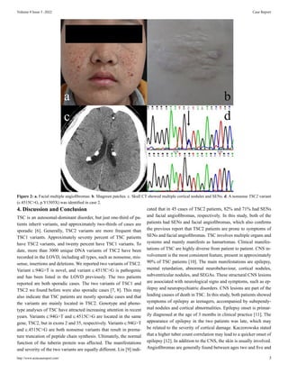 The clinical characteristics and the pathogenic gene mutations in two sporadic cases with tuberous sclerosis complex