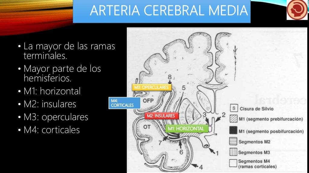 arteria cerebral media