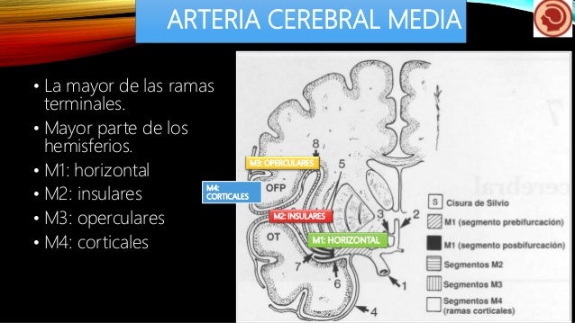 arteria cerebral media
