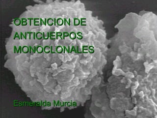 OBTENCION DE
ANTICUERPOS
MONOCLONALES




Esmeralda Murcia
 