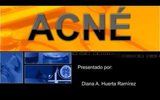 Presentado por:


 Diana A. Huerta Ramírez
 