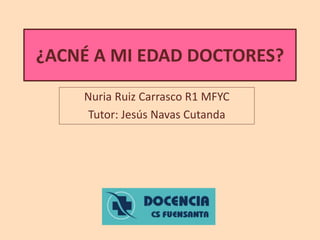 ¿ACNÉ A MI EDAD DOCTORES?
Nuria Ruiz Carrasco R1 MFYC
Tutor: Jesús Navas Cutanda
 