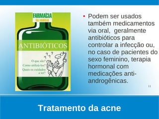 ●   Podem ser usados
             também medicamentos
             via oral, geralmente
             antibióticos para
             controlar a infecção ou,
             no caso de pacientes do
             sexo feminino, terapia
             hormonal com
             medicações anti-
             androgênicas.
                                 11




Tratamento da acne
 