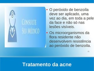 ●   O peróxido de benzoíla
            deve ser aplicado, uma
            vez ao dia, em toda a pele
            da face e não só nas
            lesões visíveis.
        ●   Os microorganismos da
            flora residente não
            desenvolvem resistência
            ao peróxido de benzoíla.
                                  15




Tratamento da acne
 
