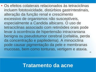 ●   Os efeitos colaterais relacionados às tetraciclinas
    incluem fototoxicidade, distúrbios gastrintestinais,
    alteração da função renal e crescimento
    excessivo de organismos não susceptíveis,
    especialmente a Candida albicans. O uso de
    tetraciclinas associado com retinóides orais pode
    levar à ocorrência de hipertensão intracraniana
    benigna ou pseudotumor cerebral (cefaléia, perda
    da concentração e papiledema). A minociclina
    pode causar pigmentação da pele e membranas
    mucosas, bem como tonturas, vertigem e ataxia.
                                                       28




               Tratamento da acne
 
