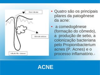 ●   Quatro são os principais
       pilares da patogênese
       da acne:
   ●    a comedogênese
       (formação do cômedo),
       a produção de sebo, a
       colonização bacteriana
       pelo Propionibacterium
       acnes (P. Acnes) e o
       processo inflamatório. 3


ACNE
 