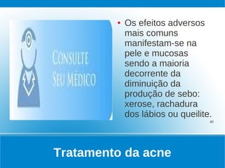 ●   Os efeitos adversos
             mais comuns
             manifestam-se na
             pele e mucosas
             sendo a maioria
             decorrente da
             diminuição da
             produção de sebo:
             xerose, rachadura
             dos lábios ou queilite.
                                   40




Tratamento da acne
 