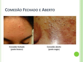 COMEDÃO FECHADO E ABERTO 
 