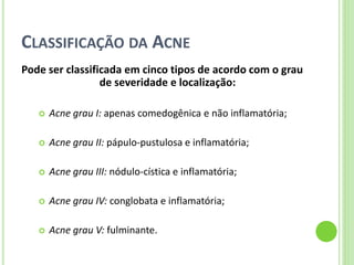 CLASSIFICAÇÃO DA ACNE 
Pode ser classificada em cinco tipos de acordo com o grau de severidade e localização: 
Acne grau I: apenas comedogênica e não inflamatória; 
Acne grau II: pápulo-pustulosa e inflamatória; 
Acne grau III: nódulo-cística e inflamatória; 
Acne grau IV: conglobata e inflamatória; 
Acne grau V: fulminante.  