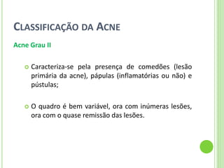 CLASSIFICAÇÃO DA ACNE 
Acne Grau II 
Caracteriza-se pela presença de comedões (lesão primária da acne), pápulas (inflamatórias ou não) e pústulas; 
O quadro é bem variável, ora com inúmeras lesões, ora com o quase remissão das lesões.  