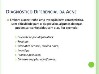 DIAGNÓSTICO DIFERENCIAL DA ACNE 
Embora a acne tenha uma evolução bem característica, sem dificuldade para o diagnóstico, algumas doenças podem ser confundidas com elas. Por exemplo: 
Foliculites e pseudofoliculites; 
Rosácea; 
Dermatite perioral, miliária rubra; 
Impetigo; 
Psoríase pustulosa; 
Diversas erupções acneiformes.  
