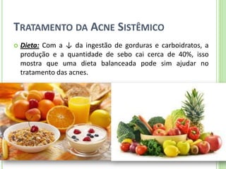 TRATAMENTO DA ACNE SISTÊMICO 
Dieta: Com a ↓ da ingestão de gorduras e carboidratos, a produção e a quantidade de sebo cai cerca de 40%, isso mostra que uma dieta balanceada pode sim ajudar no tratamento das acnes.  