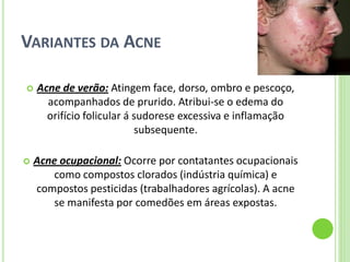 VARIANTES DA ACNE 
Acne de verão: Atingem face, dorso, ombro e pescoço, acompanhados de prurido. Atribui-se o edema do orifício folicular á sudorese excessiva e inflamação subsequente. 
Acne ocupacional: Ocorre por contatantes ocupacionais como compostos clorados (indústria química) e compostos pesticidas (trabalhadores agrícolas). A acne se manifesta por comedões em áreas expostas.  