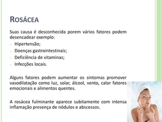ROSÁCEA 
Suas causa é desconhecida porem vários fatores podem desencadear exemplo: 
oHipertensão; 
oDoenças gastrointestinais; 
oDeficiência de vitaminas; 
oInfecções locais. 
Alguns fatores podem aumentar os sintomas promover vasodilatação como luz, solar, álcool, vento, calor fatores emocionais e alimentos quentes. 
A rosácea fulminante aparece subitamente com intensa inflamação presença de nódulos e abscessos.  