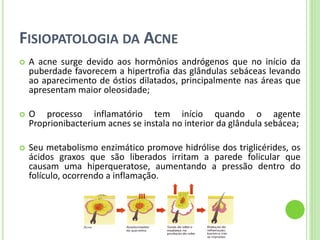 FISIOPATOLOGIA DA ACNE 
A acne surge devido aos hormônios andrógenos que no início da puberdade favorecem a hipertrofia das glândulas sebáceas levando ao aparecimento de óstios dilatados, principalmente nas áreas que apresentam maior oleosidade; 
O processo inflamatório tem início quando o agente Proprionibacterium acnes se instala no interior da glândula sebácea; 
Seu metabolismo enzimático promove hidrólise dos triglicérides, os ácidos graxos que são liberados irritam a parede folicular que causam uma hiperqueratose, aumentando a pressão dentro do folículo, ocorrendo a inflamação.  