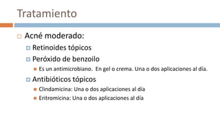 Tratamiento
 Acné moderado:
 Retinoides tópicos
 Peróxido de benzoilo
 Es un antimicrobiano. En gel o crema. Una o dos aplicaciones al día.
 Antibióticos tópicos
 Clindamicina: Una o dos aplicaciones al día
 Eritromicina: Una o dos aplicaciones al día
 
