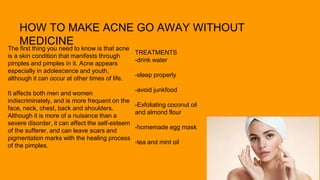 HOW TO MAKE ACNE GO AWAY WITHOUT
MEDICINE
The first thing you need to know is that acne
is a skin condition that manifests through
pimples and pimples in it. Acne appears
especially in adolescence and youth,
although it can occur at other times of life.
It affects both men and women
indiscriminately, and is more frequent on the
face, neck, chest, back and shoulders.
Although it is more of a nuisance than a
severe disorder, it can affect the self-esteem
of the sufferer, and can leave scars and
pigmentation marks with the healing process
of the pimples.
TREATMENTS
-drink water
-sleep properly
-avoid junkfood
-Exfoliating coconut oil
and almond flour
-homemade egg mask
-tea and mint oil
 