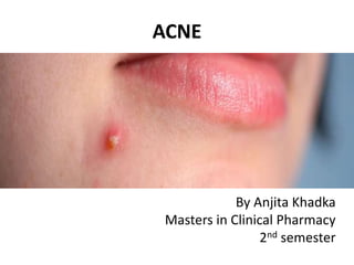 ACNE
By Anjita Khadka
Masters in Clinical Pharmacy
2nd semester
 