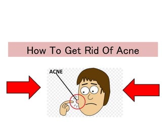 How To Get Rid Of Acne
 