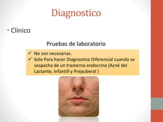 Diagnostico
• Clinico
 No son necesarias.
 Solo Para hacer Diagnostico Diferencial cuando se
sospecha de un trastorno endocrino (Acné del
Lactante, Infantill y Prepuberal )
Pruebas de laboratorio
 