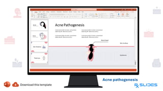Acne pathogenesis
whiteheads can
turn into
blackheads with
open pores
 