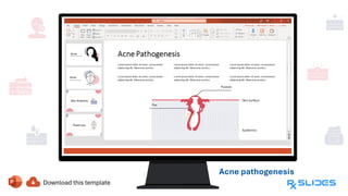 Acne pathogenesis
When fighting
the infection,
they turn into
pustules
 