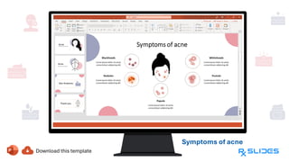 Symptoms of acne
Blackheads,
Whiteheads,
Papule, Pustule,
and Nodules
 
