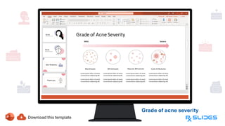 Grade of acne severity
Severity from mild
to severe are
(Blackheads,
Whiteheads,
Papules and
pustules, and
Cysts and
nodules)
 
