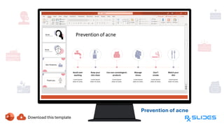 Prevention of acne
Avoiding
washing,
keeping your
skin clean,
managing
stress, using
non-
comedogenic
products,
don’t
smoking, and
watching
your diet
 